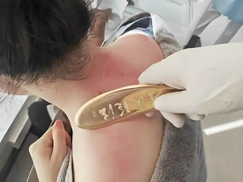 刮痧清肺：气血好运行