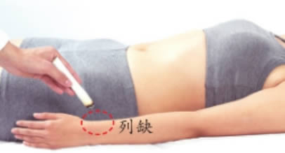 艾灸百会穴镇痛止晕清热开窍